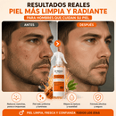 🔥 Dr. Melaxin Peel Shot Rice Ampoule™ | Ayuda a Reducir Manchas y Mejorar la Apariencia de la Piel